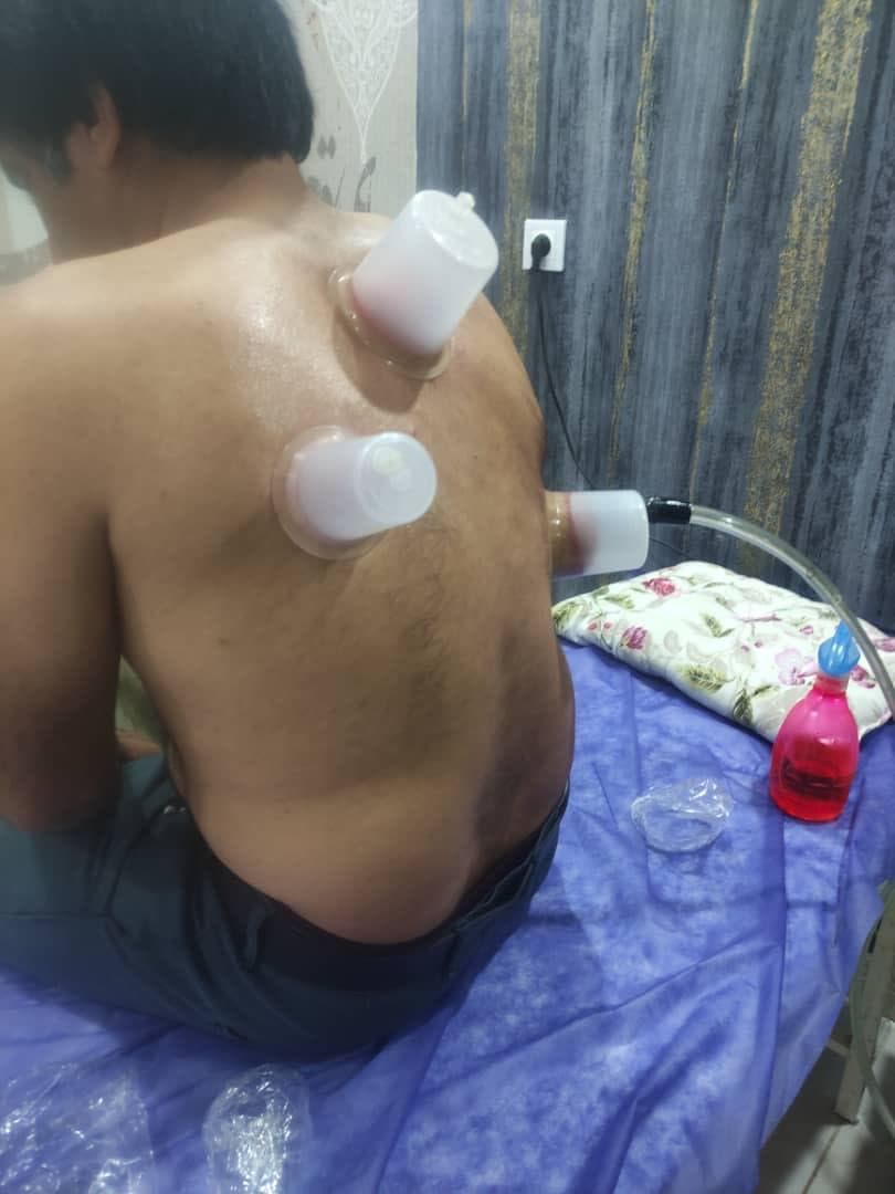 خدمات تخصصی حجامت و زالو درمانی رایحه سیب طبیب امکی در ایلام