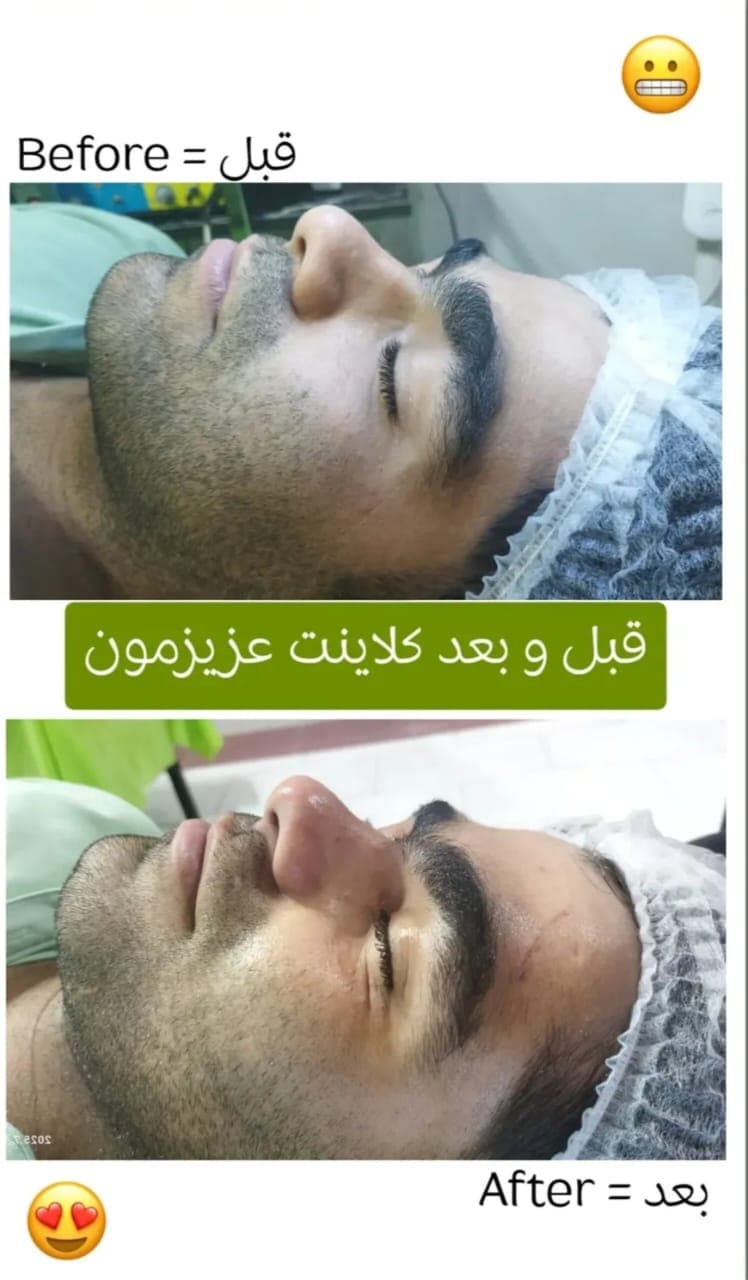 آموزش و درمان جوش و اسکار مرضیه سجادیان در کرمانشاه