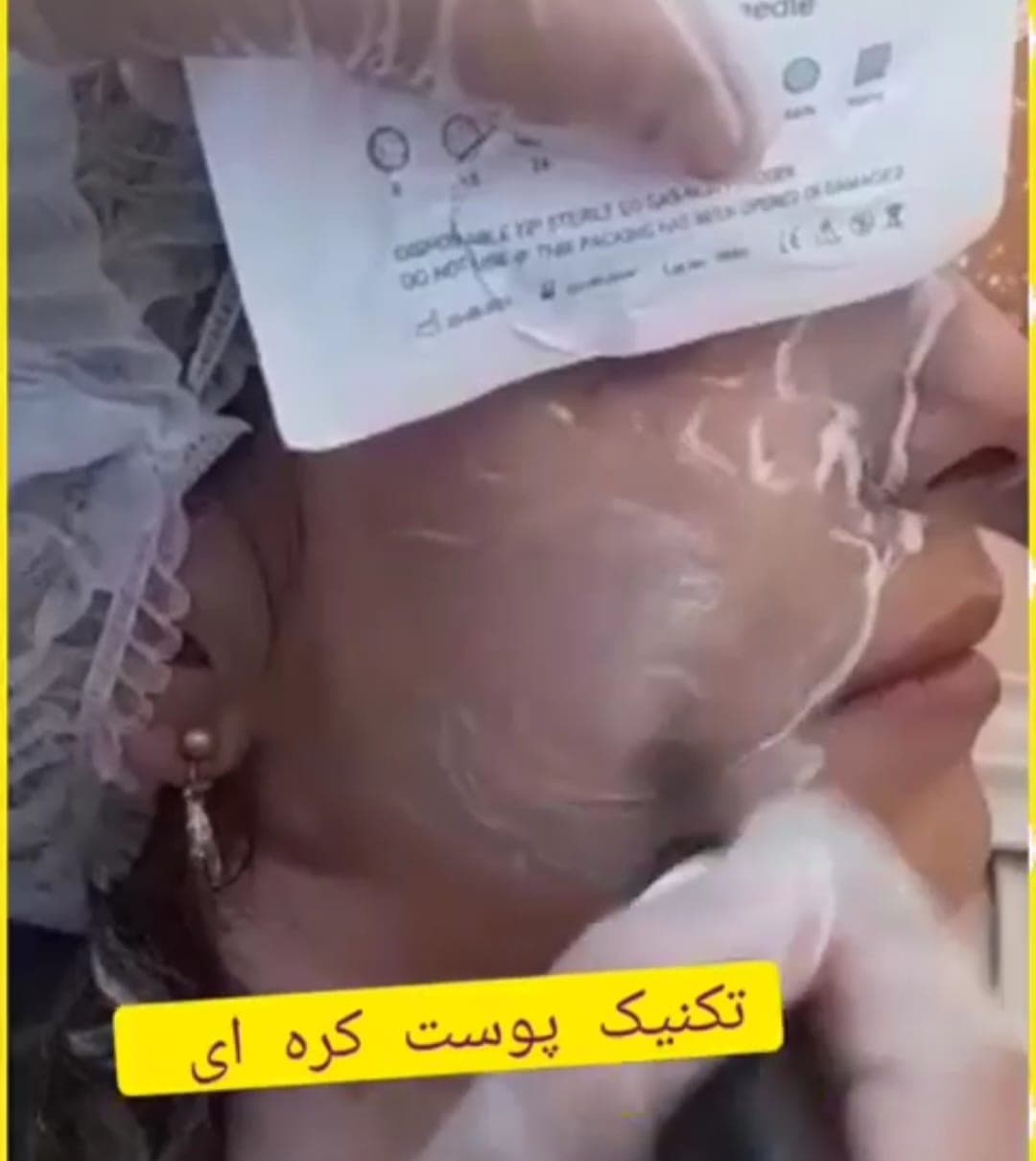 آموزش و درمان جوش و اسکار مرضیه سجادیان در کرمانشاه