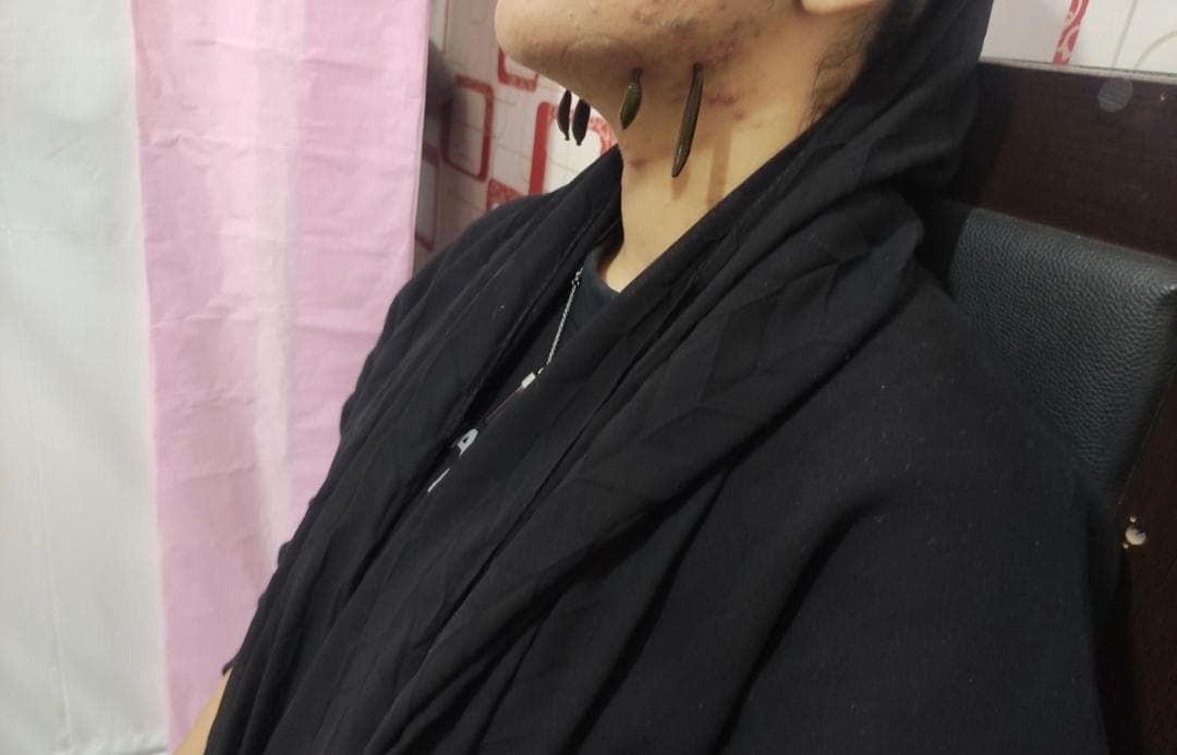 خدمات تخصصی حجامت و زالو درمانی رایحه سیب طبیب امکی در ایلام